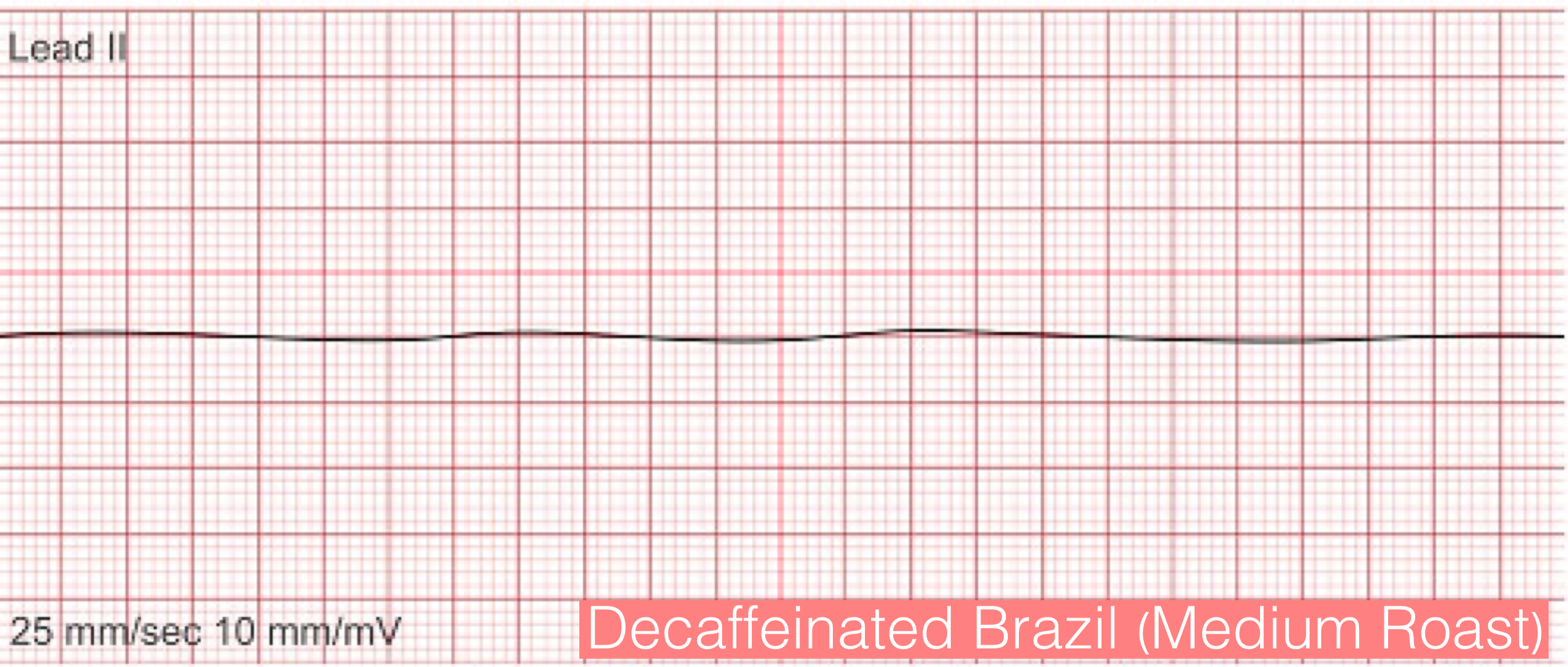 Brazil Decaffeinated (Medium Roast) Coffee